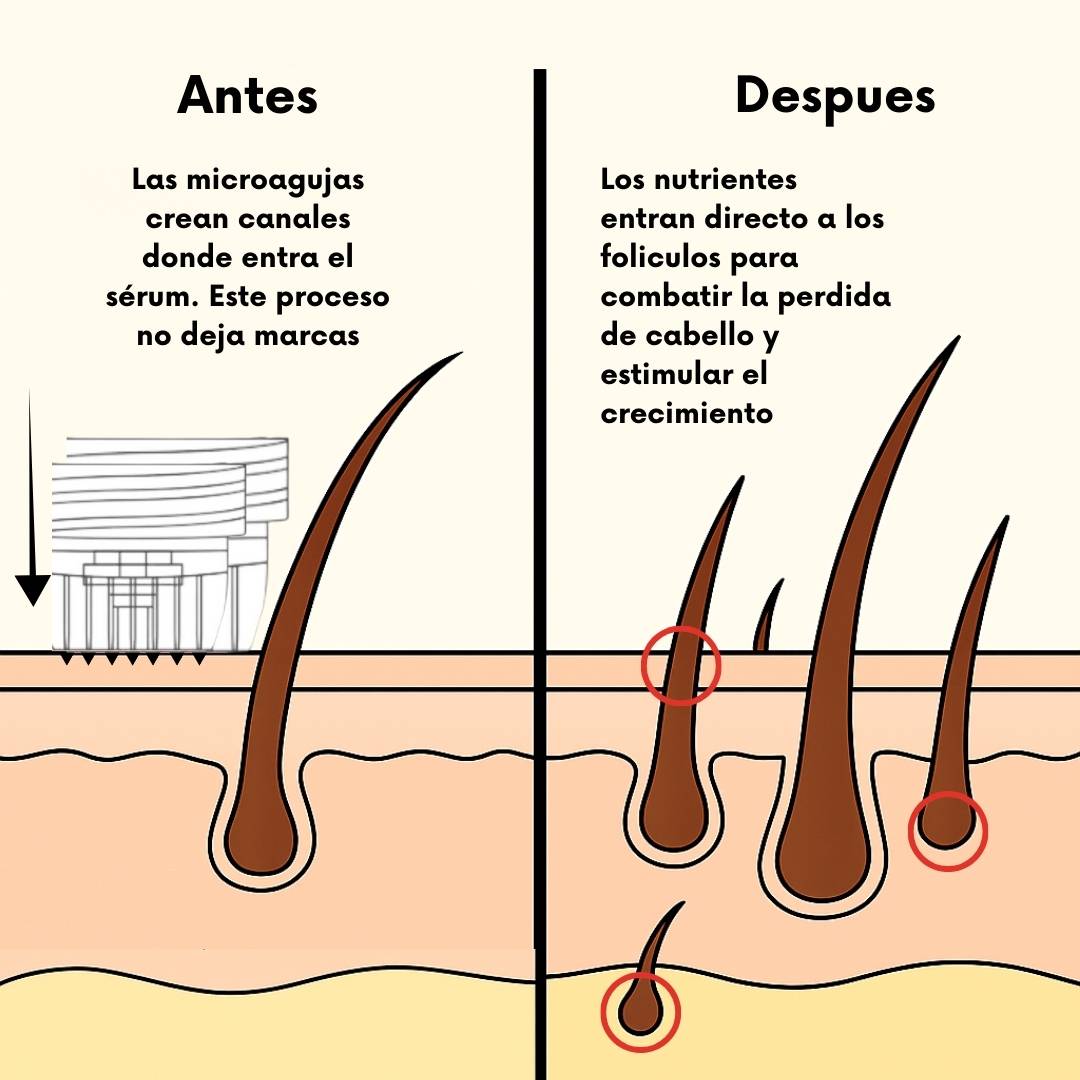 RegenCapilar™ Sérum Intensivo - Sistema de Regeneración Capilar - RegenCapilar