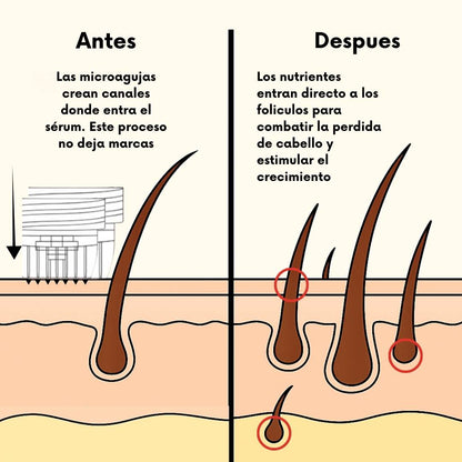 RegenCapilar™ Sérum Intensivo - Sistema de Regeneración Capilar - RegenCapilar