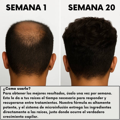 RegenCapilar™ Sérum Intensivo - Sistema de Regeneración Capilar - RegenCapilar
